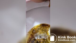 Girl Lactose Intolerance Diarrhea