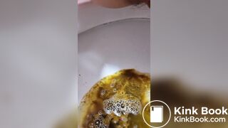 Girl Lactose Intolerance Diarrhea