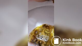 Girl Lactose Intolerance Diarrhea