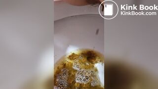 Girl Lactose Intolerance Diarrhea