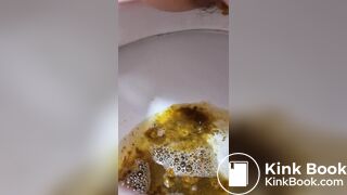 Girl Lactose Intolerance Diarrhea