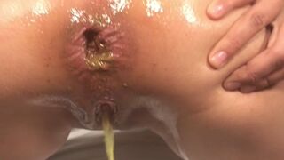 SCATVID №2 - Pornstar (J.M.) Dirty Anal