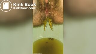 Ruining The Toilet Bowl With My Urgent Diarrhea ♡