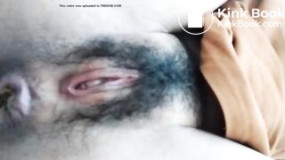 20241108 a hump of shit