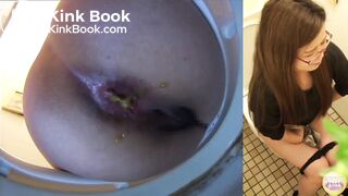 Diarrhea with no toilet paper after poop