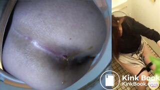 Diarrhea with no toilet paper after poop