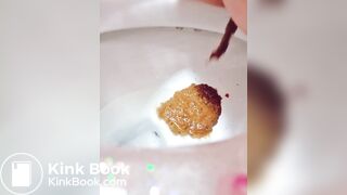 Explosive diarrhea - video 27