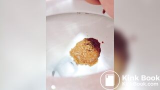 Explosive diarrhea - video 27