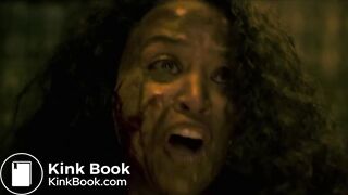 Septic man diarrhea and vomit