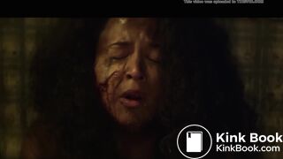 Septic man diarrhea and vomit