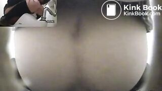 Classic constipation (multiple view)