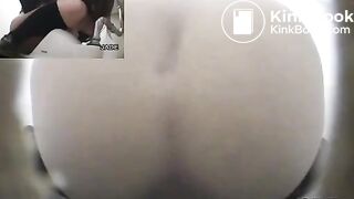 Classic constipation (multiple view)