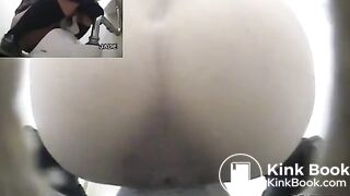 Classic constipation (multiple view)