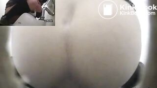 Classic constipation (multiple view)