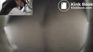 Classic constipation (multiple view)