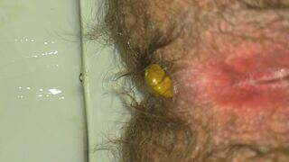 Farting Out Little Cannonballs & Pissing On Them