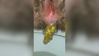 Pushing Out A Thick Turd