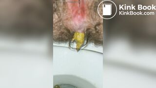 Pushing Out A Thick Turd