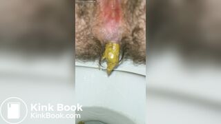 Pushing Out A Thick Turd