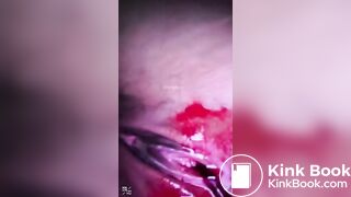 spy camera asian girl pee and shit.video_170