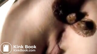 Old Alice Vid Pooping Complication