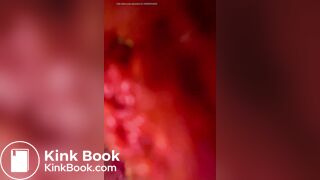 Japanese Twitter girl Poop on the camera