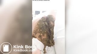 explosive diarrhea pants blowout