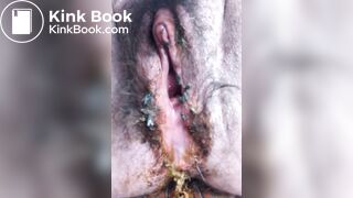 flies in dirty smelly pussy