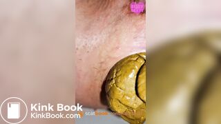 Extreme prolapse huge close up shit