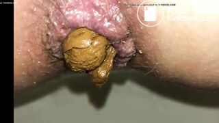 Compilation hairy and dirty assholes shitting