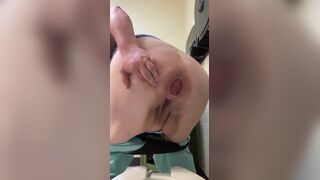 woman with Prolaps anal takes a shit with a bit of cum