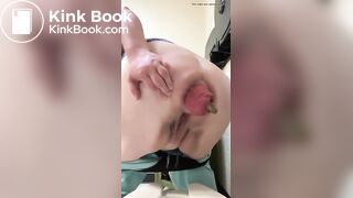 woman with Prolaps anal takes a shit with a bit of cum