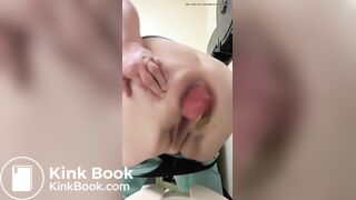 woman with Prolaps anal takes a shit with a bit of cum