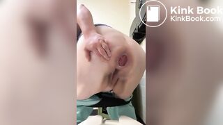 woman with Prolaps anal takes a shit with a bit of cum