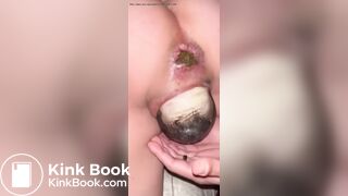 Birth X poop compilation ep2