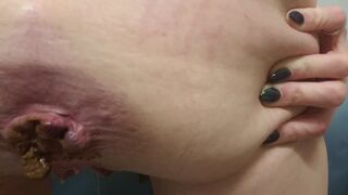 anus féminin en action