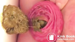 real prolapse girl pooping