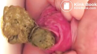 real prolapse girl pooping