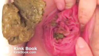 real prolapse girl pooping