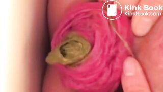 real prolapse girl pooping