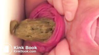 real prolapse girl pooping