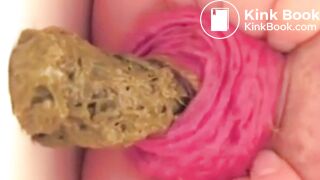 real prolapse girl pooping