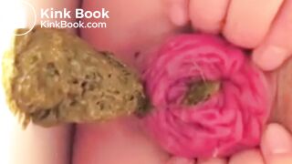 real prolapse girl pooping