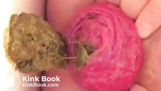 real prolapse girl pooping