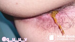 Gassy shit - video 23