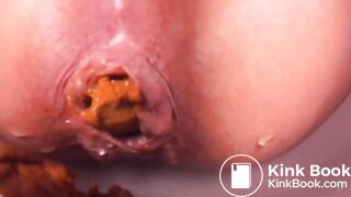 Another Anal Closeup Shitting 2