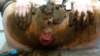 Prolapsed scat..
