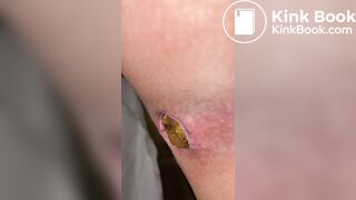 beautiful poop