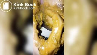 Girl diarrhea on her boyfriend hand