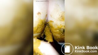 Girl diarrhea on her boyfriend hand